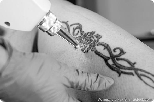 Tatuagens Podem Causar C^ancer? image 0